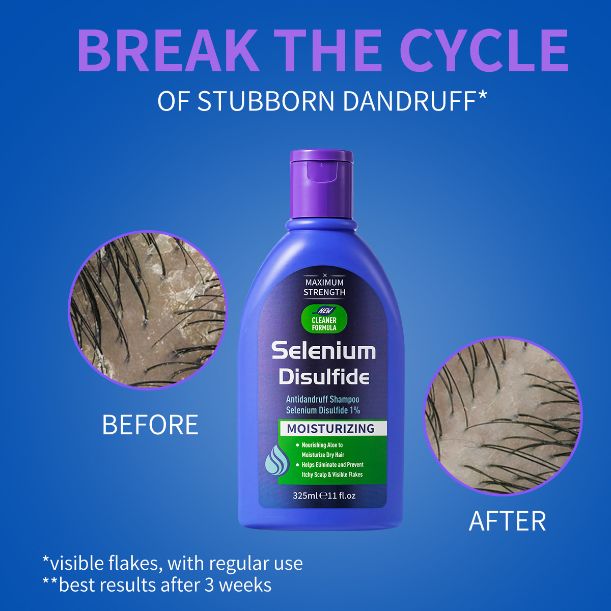 Шампунь против перхоти с дисул – обзор и цена Hair Care Dandruff